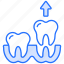 fillings, cavity, swelling, gingival, bacteria, periodontal-disease, gingivitis, healthcare, teeth-protection 