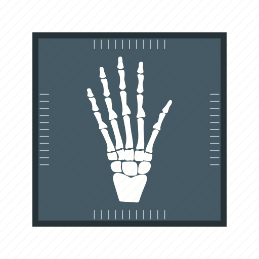 Hand x ray, medical, care, treatment icon - Download on Iconfinder