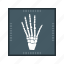 hand x ray, medical, care, treatment 