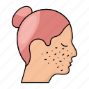 female, facial treatment, blemishes, acne treatment, woman