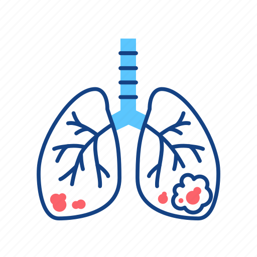 Cancer, growth, human, lungs, malignant neoplasm, organ, tumor icon - Download on Iconfinder