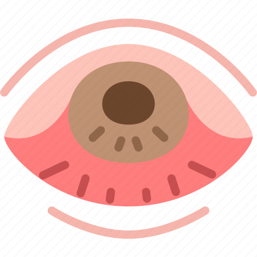 Conjunctivitis, eye, irritation, infected, allergic icon - Download on Iconfinder