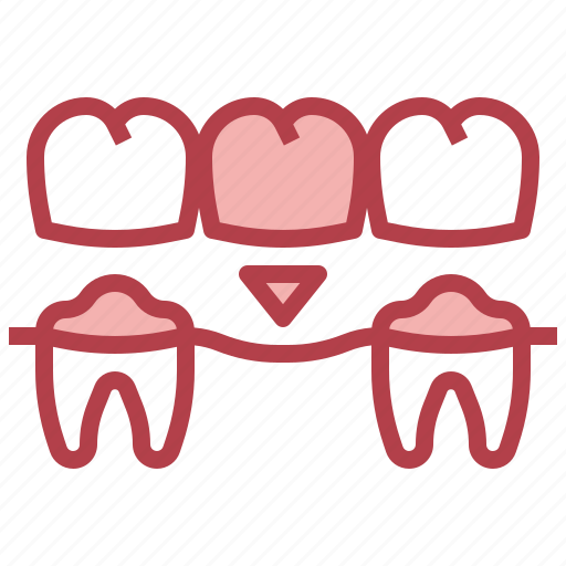 Dental, bridge, orthodontic, healthcare, medical, molar, dentist icon - Download on Iconfinder