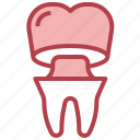 dental, crown, implant, dentist, tooth