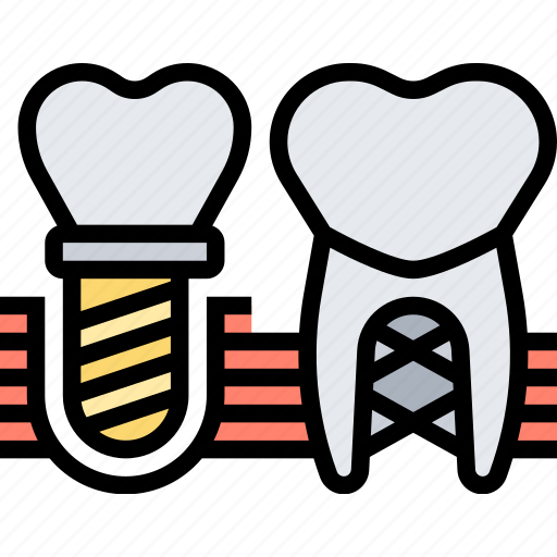 Implant, dental, tooth, crown, prosthesis icon - Download on Iconfinder