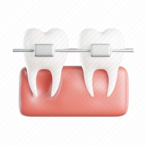 Brace, dental care, dentist, tooth, medical, healthcare 3D illustration - Download on Iconfinder