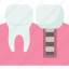 implant, tooth, crown, dentistry, treatment 