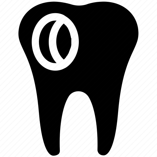 Caries, dental, dentist, hole, stomatology, tooth icon - Download on Iconfinder