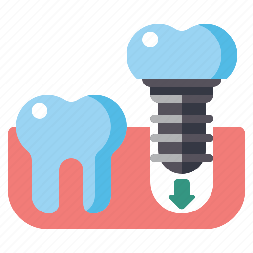 Implant, tooth, dental icon - Download on Iconfinder
