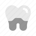 tooth, implant, dental, dentistry, prosthesis, fixture, crown