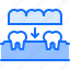 crown, dental, dentist, implant, medicine, tooth 