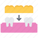 crown, dental, dentist, implant, medicine, tooth