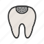 care, cavity, decay, hole, medical, teeth, tooth 