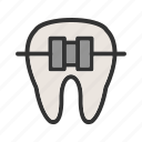 braces, dental, dentist, mouth, orthodontics, smile, teeth