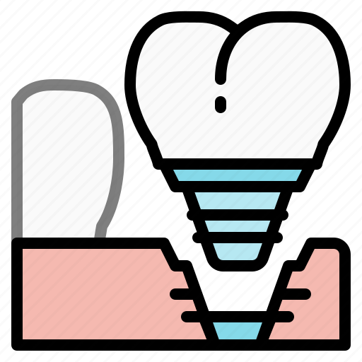 Dental, dentist, implants, mouth, premolar, teeth, tooth icon - Download on Iconfinder