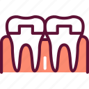 dentistry, crowned, teeth, tooth