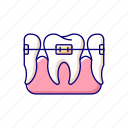 orthodontic, jaw, braces, dentistry