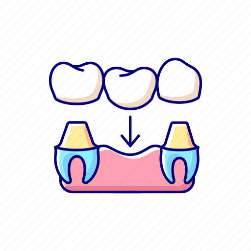Tooth, dentist, prosthetic, treatment icon - Download on Iconfinder
