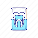 tooth, xray, procedure, radiology
