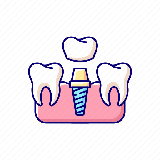 Prosthetic, dentist, tooth, implant icon - Download on Iconfinder
