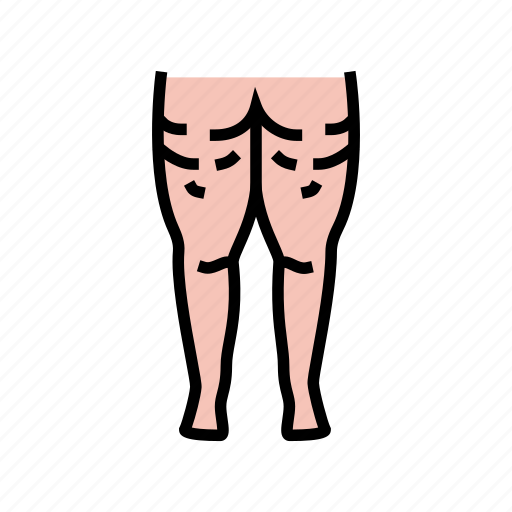 Cellulite, problem, disease, human, surgery, epithelial icon - Download on Iconfinder