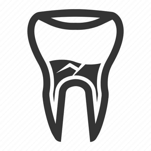 Cavity, dental, dental health, health, teeth, tooth decay icon - Download on Iconfinder