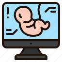 ultrasound, scan, baby, pregnancy, pregnant, kid, monitor