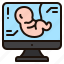 ultrasound, scan, baby, pregnancy, pregnant, kid, monitor 