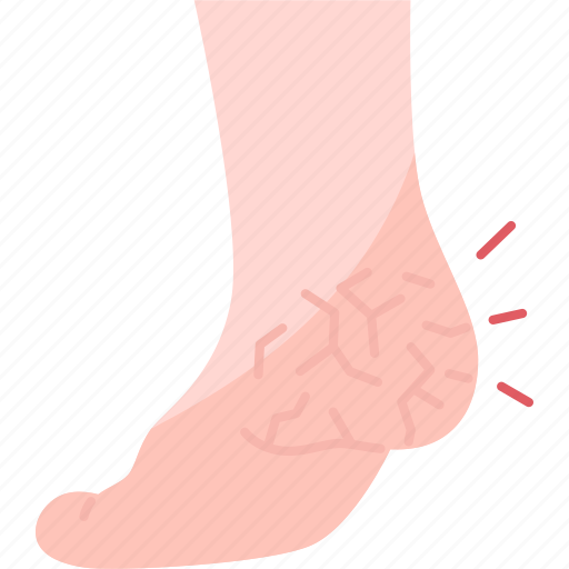 Foot, heel, cracked, pedicure, care icon - Download on Iconfinder