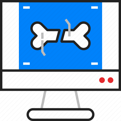 Ray, bone, roentgen icon - Download on Iconfinder
