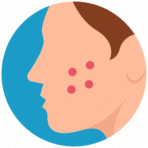 Healthcare, acne, blackhead, pimple, face, allergy icon - Download on Iconfinder