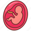 fetus, baby, pregnancy, embryo, ultrasound, fetal, monitoring, stage 