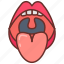 tonsil, palatine, faucial, lymphoid, tissue, tonsillar, crypts 