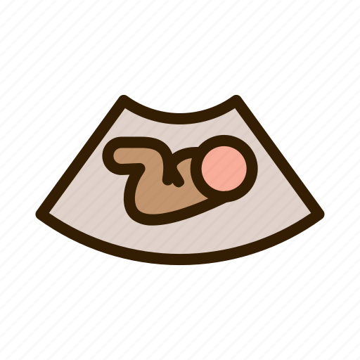 Pregnants, baby, maternity, maternal, fetal, womb, scan icon - Download on Iconfinder