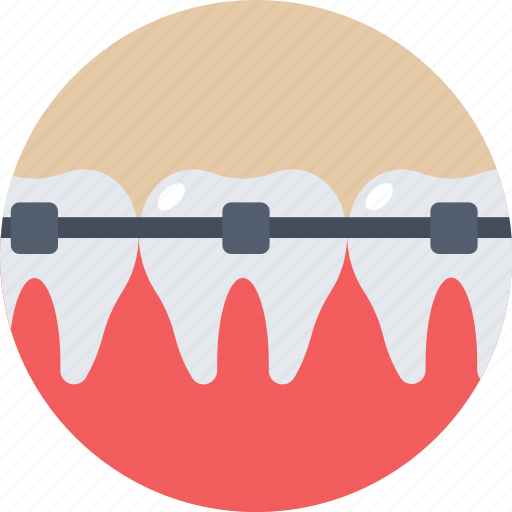Braces, dental braces, dental brackets, medical, teeth braces icon - Download on Iconfinder