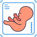 antenatal care, baby, child, hospital, medical, pregnancy, ultrasound