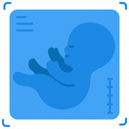 Antenatal care, baby, child, hospital, medical, pregnancy, ultrasound icon - Download on Iconfinder