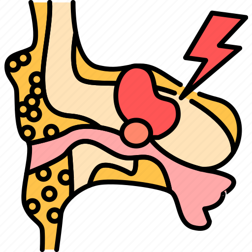 Cholesteatoma, cyst, eardrum icon - Download on Iconfinder