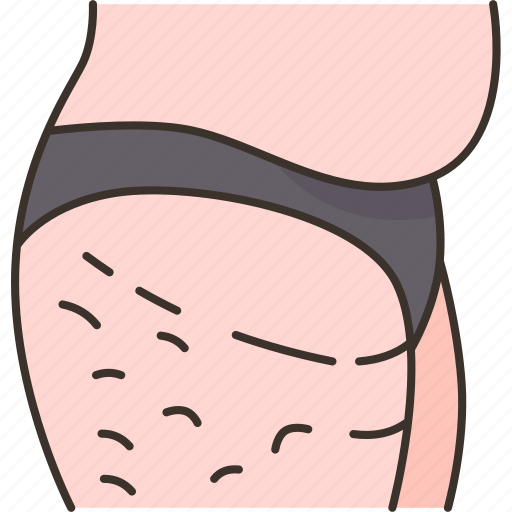 Cellulite, body, fat, obesity, overweight icon - Download on Iconfinder