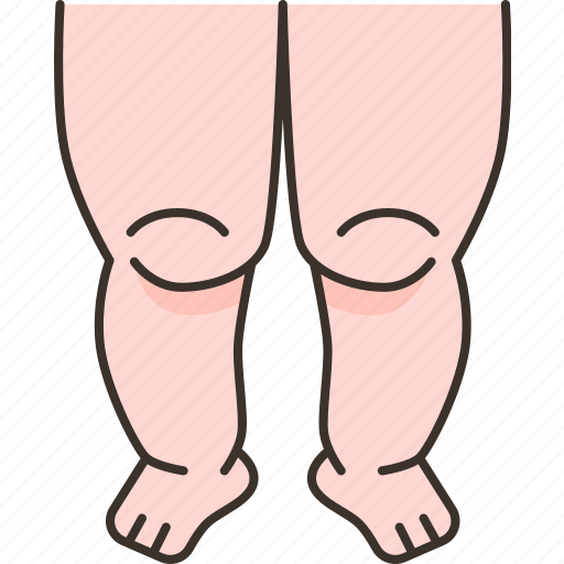 Legs, fat, overweight, obese, body icon - Download on Iconfinder