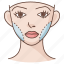 cheek, cheekbone, cosmetic, facial, plastic, reconstruction, surgery 