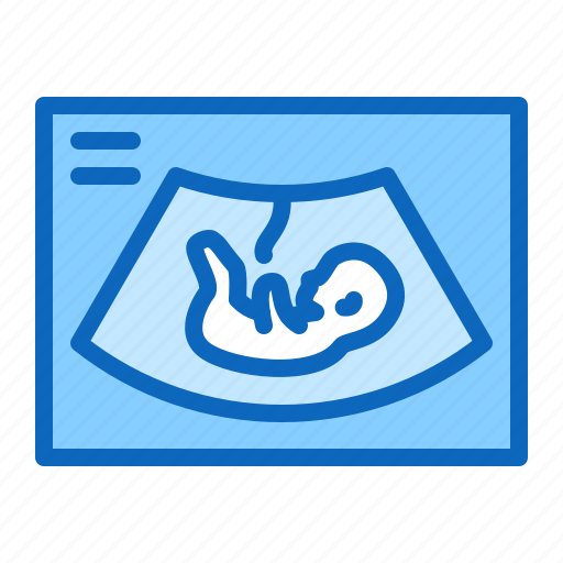 Baby, embryo, obstetrics, ultrasound icon - Download on Iconfinder