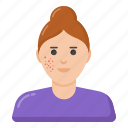 pimples, acne skin, female acne face, dermatology, skin infection