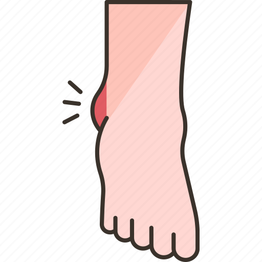 Sprains, ligaments, tearing, ankle, injury icon - Download on Iconfinder