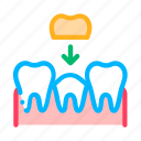 crown, stomatology, tooth