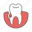 blood, dental, gingivitis, gum bleeding, periodontitis, teeth, tooth 