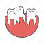 crooked teeth, dental, malocclusion, oral cavity, stomatology, teeth, tooth 