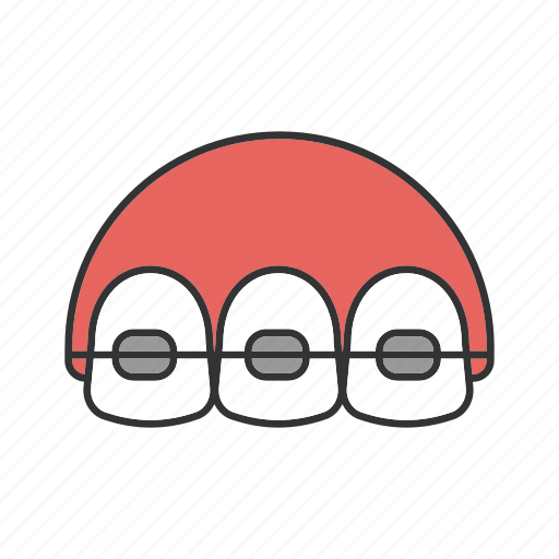 Aligners, braces, dental braces, retainers, stomatology, teeth, tooth icon - Download on Iconfinder
