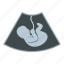 baby, child, fetus, person, pregnancy, pregnant, ultrasound 